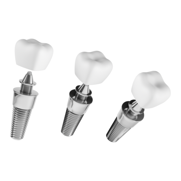 Dental Implant - Image 2