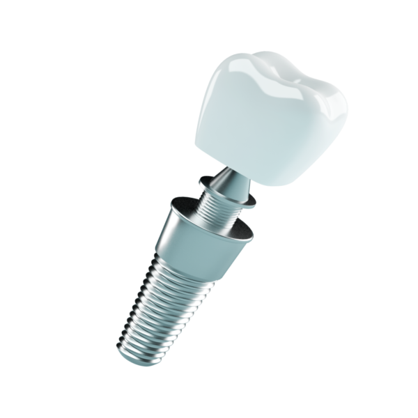 Dental Implants - Image 2